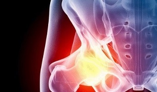 reasons for the development of hip osteoarthritis