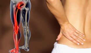 Characteristics of back pain
