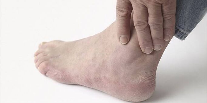 pain in osteoarthritis of the ankle