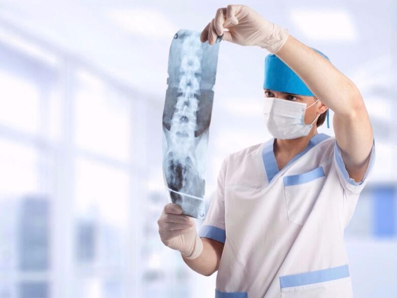 the doctor looks at a picture of the cervical spine with osteochondrosis